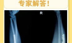 骨科影像迈向智能化时代，凯利泰助力精准诊疗